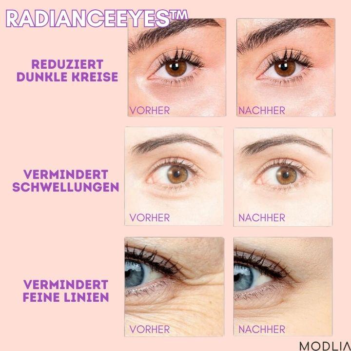 50% RABATT TEMPORÄR | RadianceEyes™ | Erleben Sie Augenmassage jederzeit und überall! - MODLIA